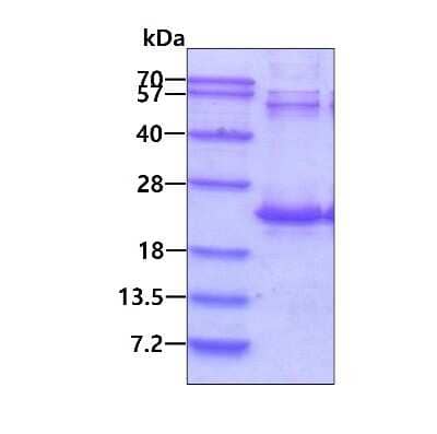 SDS-Page: Recombinant Human DR1 His Protein [NBP1-45319] - 3ug by SDS-PAGE under reducing condition and visualized by coomassie blue stain